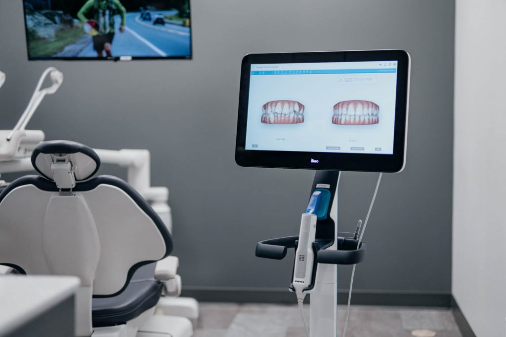 iTero Digital Scanner | Lynnwood Dental | General & Family Dentist | SE Calgary