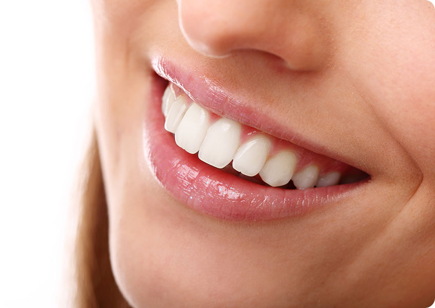 Porcelain Veneers | Lynnwood Dental | General & Family Dentist | SE Calgary